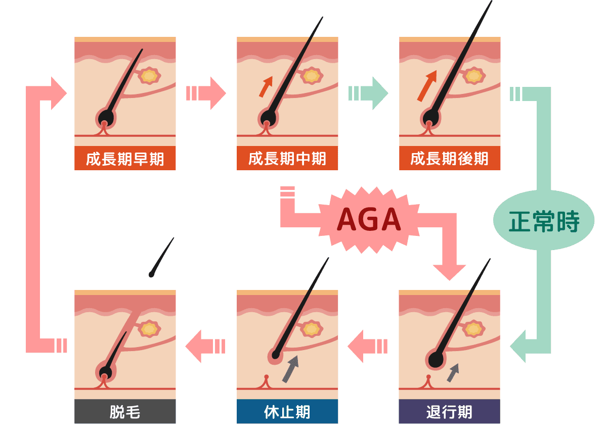 髪のサイクル